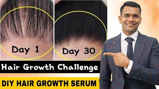 Powerful Hair Growth Serum For Extreme Hair Growth  Regrow Lost Hair Get Double Density in 30 days [upl. by Eikcin781]