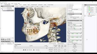 9 Basic cephalometry [upl. by Eimile]