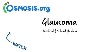 Glaucoma  Clinical Presentation [upl. by Pravit]