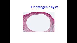 Odontogenic Cysts [upl. by Publus]