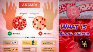 blood anemia।what is blood anemia। एनीमिया क्या है। [upl. by Refenej]