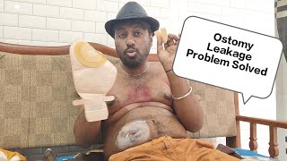 Ostomy leakage problem solution Hindi  how to change ostomy bag nursing  How to change ostomy bag [upl. by Elleinaj]