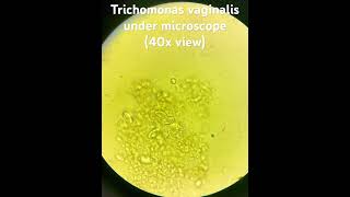 Trichomonas under microscope 40xview Pathology [upl. by Kiona]