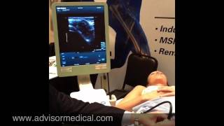 Ultrasound Guided Hip Injection [upl. by Skippie]