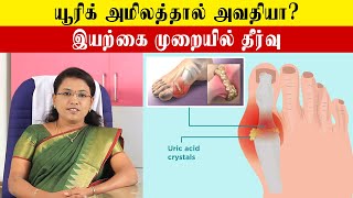 How to Cure Uric Acid Problems  Control Uric Acids  யூரிக் அமிலத்தை கட்டுப்படுத்துவது எப்படி [upl. by Idnahr]