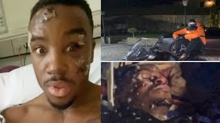 Bugzy Malone Recovers In Hospital After Horror Bike Crash MusicNews [upl. by Rostand]