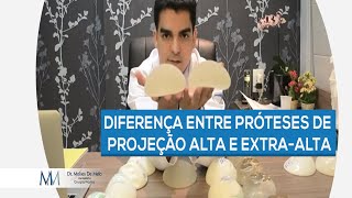 Dr Moises De Melo  Diferença entre próteses de projeção alta e extraalta [upl. by Connors]