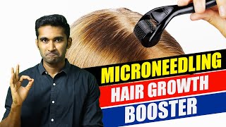 How to do MICRONEEDLING at home for HAIR GROWTHதமிழ் tamil haircare hairgrowth hairloss [upl. by Xela]