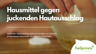 Hausmittel gegen juckenden Hautausschlag [upl. by Cecilius]