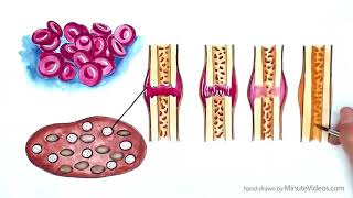 PRP for Bone Fractures [upl. by Cristy608]