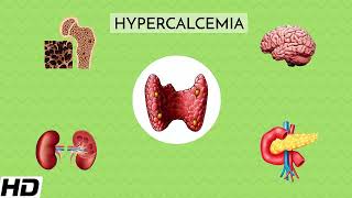 Hypercalcaemia Everything You Need to Know [upl. by Ynad890]