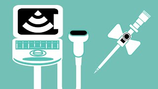 Ultra Sound Guided Cannulation [upl. by Murray]