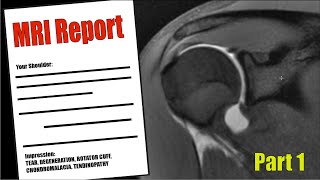 Shoulder PAIN  Understand your MRI Report [upl. by Eahc]