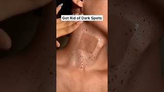 ✅️ Neck Cleaning Tips Dark Neck Home RemediesTanning Removal Tips 😱diyskincareshortsviral [upl. by Willem649]