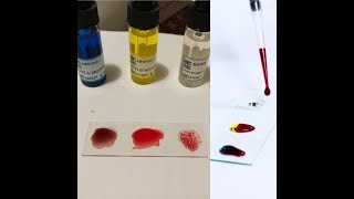 ABO Blood Grouping amp Rh Typing Slide Method [upl. by Haukom]