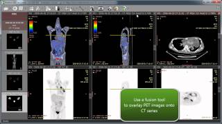 RadiAnt DICOM Viewer 104  new features [upl. by Pelson]