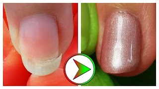 extrem eingebrochenen Nagel retten  Tutorial Nagelreparatur amp Reinigung [upl. by Nhguavoj]