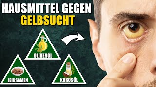 8 Natürliche Hausmittel gegen Gelbsucht [upl. by Nadeen707]