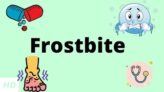 Frostbite Causes Signs and Symptoms DIagnosis and Treatment [upl. by Lehcer108]