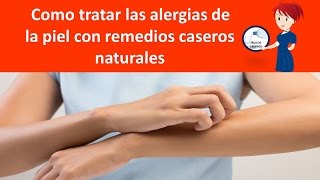 Como tratar las alergias de la piel con remedios caseros naturales [upl. by Ahsaekal872]