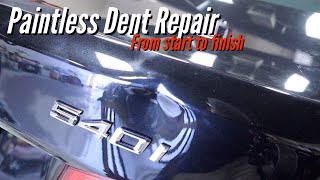 Bmw 540i Large Dent Repair  Dentless Touch  Washington DC [upl. by Akena]