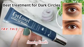 Eyeloxyl Eye Treatment  Best treatment for Dark circles [upl. by Anividul]