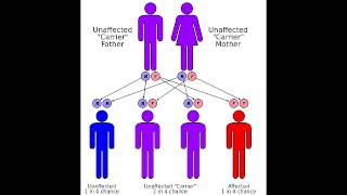 Friedreichs Ataxia  Causes Symptoms amp Mnemonics [upl. by Hulbig]