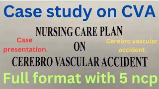 Nursing Care Plan on Cerebrovascular Accident  NCP on CVA  Case Study on CVA [upl. by Ihel897]