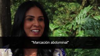 Plastic Surgeons in Colombia  Real life testimony [upl. by Nauj]