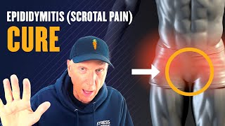 Epididymitis Scrotal Pain Treatment and Cure [upl. by Maloney]