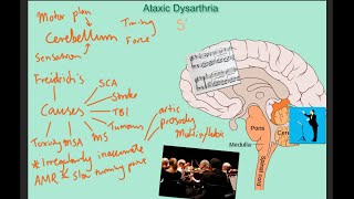 Ataxic dysarthria  samples and explanation [upl. by Cirtap]