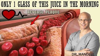 1 GLASS OF THIS JUICE IN THE MORNINGREVERSE CLOGGED ARTERIES amp LOWER HIGH BLOOD PRESSURE [upl. by Boor]