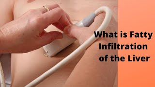 What is Fatty Infiltration of the Liver [upl. by Abbye617]