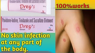 Drez S ointment uses and side effects in teluguBest ointment for skin infections [upl. by Silvano]