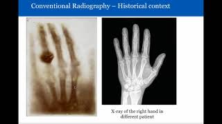 Introduction to Radiology Conventional Radiography [upl. by Soneson]