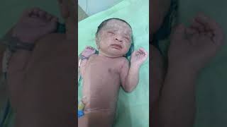 Medical Education video Neonatology Grunting respiration in a newborn [upl. by Cammi670]