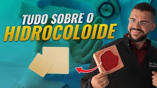 CURATIVOS  TUDO SOBRE O HIDROCOLÓIDE  AULA COMPLETA [upl. by Nylanej]