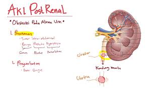 Patofisiologi  Cidera Ginjal Akut Postrenal  Azotemia  Acute Kidney Injury [upl. by Incrocci]