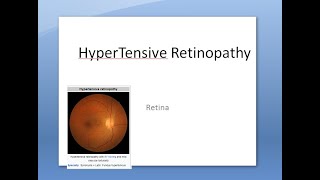 Ophthalmology 282 a Hypertensive Retinopathy HyperTension High Blood Pressure Eye Effect DisOrder [upl. by Ovida]