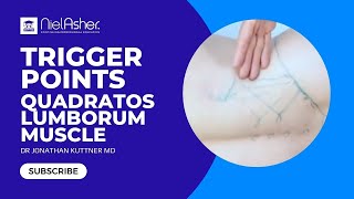 Trigger Point Release  Quadratus Lumborum [upl. by Peters]