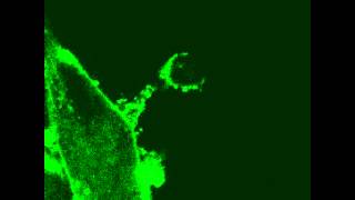 Cytoplasmic bridge connecting senescent cell and NK cell [upl. by Demmy780]