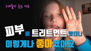 피부에 트리트먼트했더니 이렇게나 좋아졌어요 [upl. by Marji98]