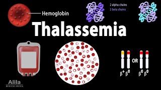 Thalassemia Alpha amp BetaThalassemias Genetics Pathophysiology Diagnosis amp Treatment Animation [upl. by Pangaro]