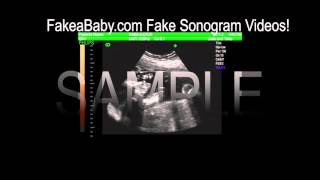 Fake Sonogram Video Sample [upl. by Yi]