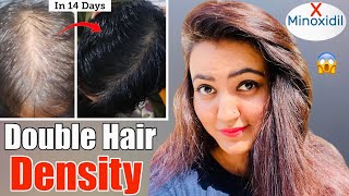 14 Days Challenge  Try This Hair Growth Remedy To Get Double Hair Density amp Thick Long Hair❤️ [upl. by Ransom]