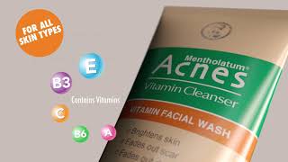 ACNES VITAMIN CLEANSER KENYA [upl. by Eziechiele]