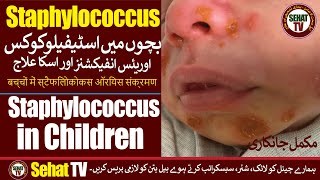 How To Treat Staphylococcus Infection In Children  Urdu Hindi  Sehat TV [upl. by Llehcsreh]