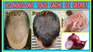 TOUT HOMME DEVRAIS SAVOIR CE SECRET REPOUSSE ACCELERER DE LA CALVITIE ET DENTRETIENT DE CHEVEUX [upl. by Lohrman964]