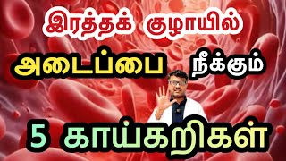 மாரடைப்பை தடுக்கும் 5 காய்கறிகள் இதோ  Eat 5 Vegetables to prevent HeartAttack  DrPillai TAMIL [upl. by Guglielmo]