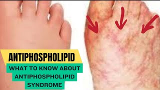 Antiphospholipid Syndrome [upl. by Thanasi]